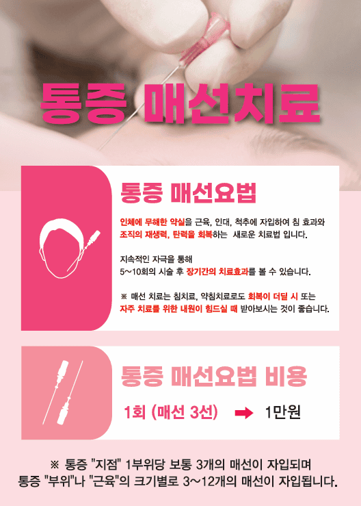 통증 매선치료 안내 및 가격표