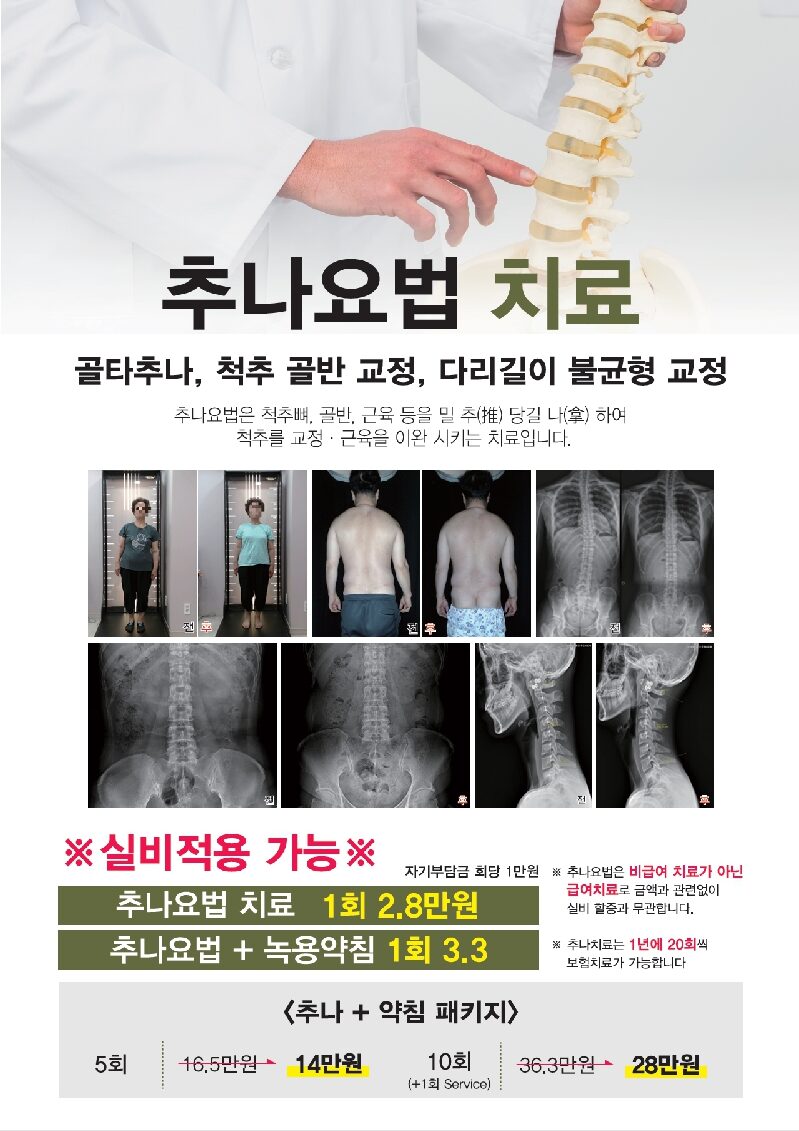 추나요법 치료 안내, 실제 체형분석·X-ray 전후 비교 사진 및 가격표